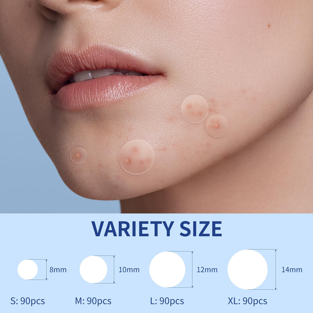 Daolyo Pimple Patches for Face, 4 Size 300 Counts Acne Patches, Hydrocolloid Patches for Covering Zits and Blemishes, Spot Stickers with Salicylic Acid, Tea Tree Oil & Calendula Oil