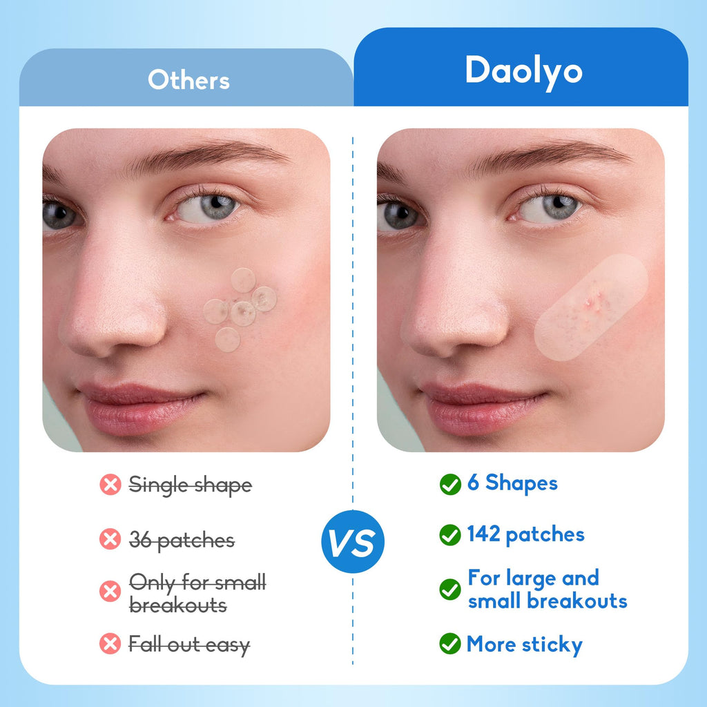 Daolyo Pimple Patches for Face, 4 Size 300 Counts Acne Patches, Hydrocolloid Patches for Covering Zits and Blemishes, Spot Stickers with Salicylic Acid, Tea Tree Oil & Calendula Oil