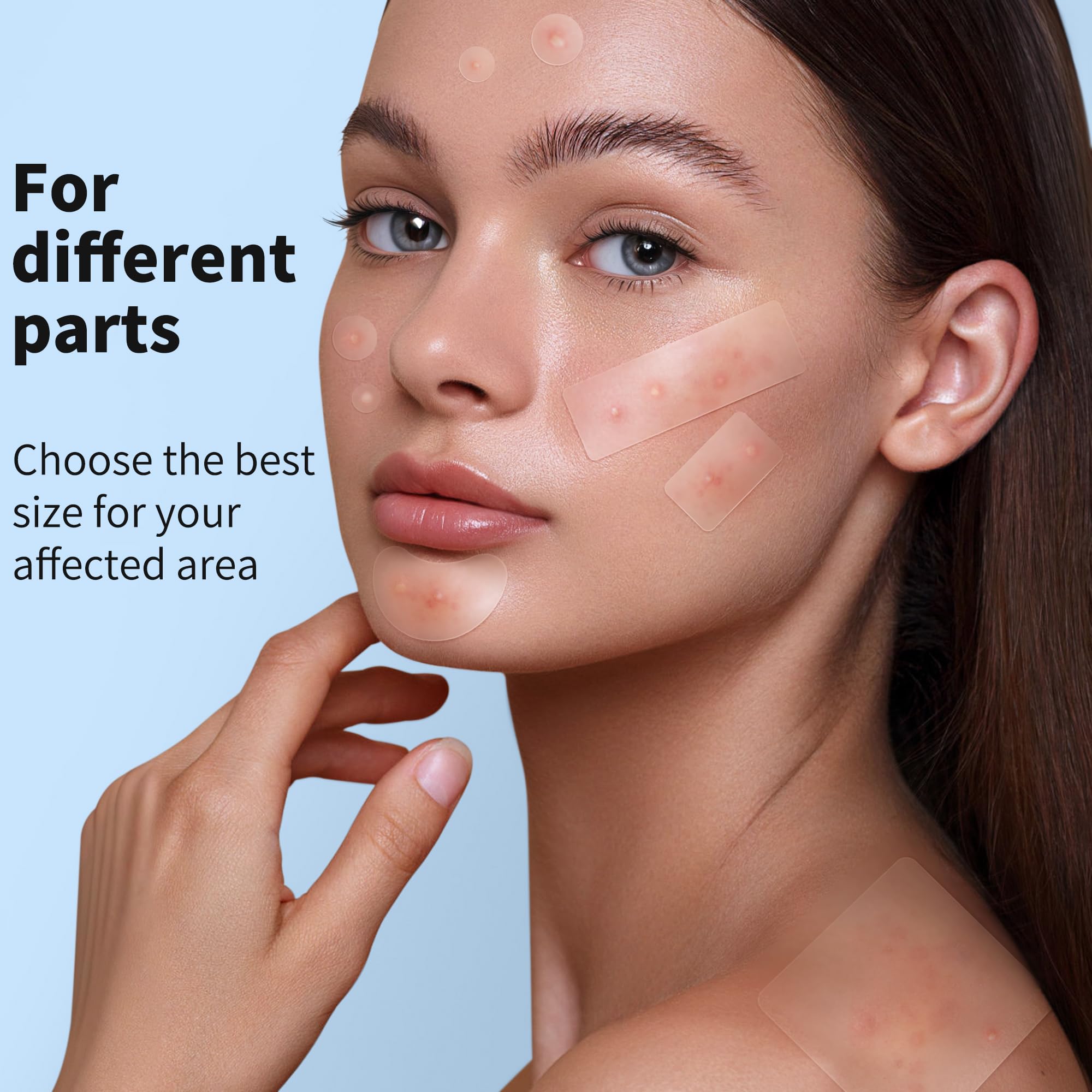 Daolyo Pimple Patches for Face, 4 Size 300 Counts Acne Patches, Hydrocolloid Patches for Covering Zits and Blemishes, Spot Stickers with Salicylic Acid, Tea Tree Oil & Calendula Oil