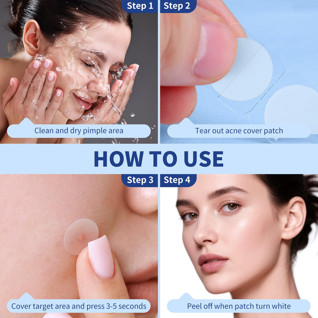 Daolyo Pimple Patches for Face, 4 Size 300 Counts Acne Patches, Hydrocolloid Patches for Covering Zits and Blemishes, Spot Stickers with Salicylic Acid, Tea Tree Oil & Calendula Oil