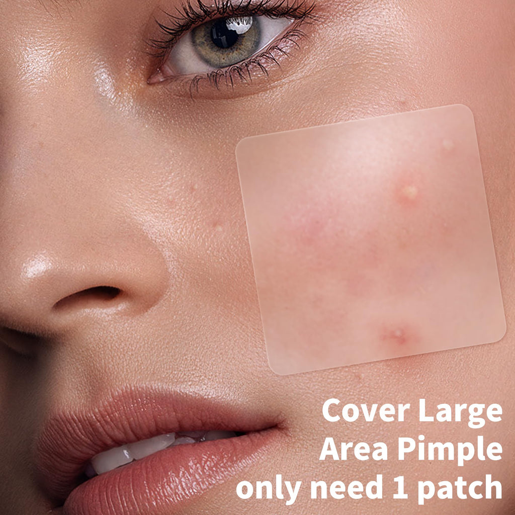 Daolyo Pimple Patches for Face, 4 Size 300 Counts Acne Patches, Hydrocolloid Patches for Covering Zits and Blemishes, Spot Stickers with Salicylic Acid, Tea Tree Oil & Calendula Oil